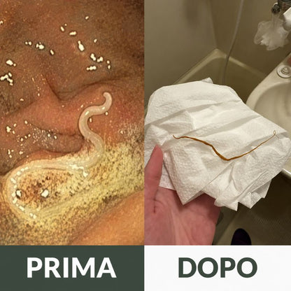 Olio di Ricino Biologico — Sgonfia la Pancia Mentre Dormi